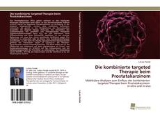 Copertina di Die kombinierte targeted Therapie beim Prostatakarzinom