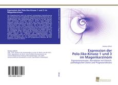 Copertina di Expression der Polo-like-Kinase 1 und 3 im Magenkarzinom