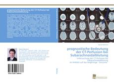 Couverture de prognostische Bedeutung der CT-Perfusion bei Subarachnoidalblutung