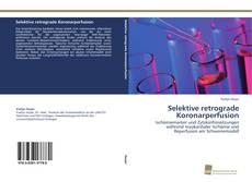 Couverture de Selektive retrograde Koronarperfusion