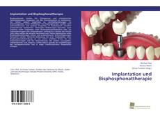 Portada del libro de Implantation und Bisphosphonattherapie