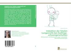 Portada del libro de Induktion der fetalen Lungenreife bei Zwillings­schwangerschaften