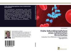 Couverture de Frühe Sekundärprophylaxe eines ischämischen Hirninfarktes