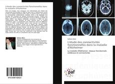 L'étude des connectivités fonctionnelles dans la maladie d'Alzheimer kitap kapağı