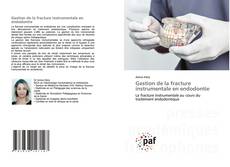 Bookcover of Gestion de la fracture instrumentale en endodontie