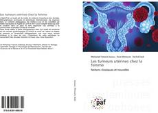 Bookcover of Les tumeurs utérines chez la femme