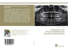 Capa do livro de Evaluation der Primärstabilität von dentalen Implantaten 