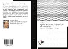Bookcover of Kystes Et Fistules Congenitaux Du Dos Du Nez