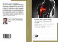 Buchcover von Les fractures fraîches de la scapula