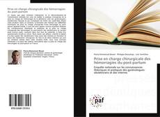 Bookcover of Prise en charge chirurgicale des hémorragies du post-partum