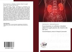 Capa do livro de Carcinomes à cellules rénales chez le sujet jeune de moins de 50 ans 
