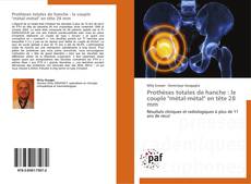 Bookcover of Prothèses totales de hanche : le couple "métal-métal" en tête 28 mm