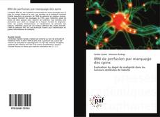 Buchcover von IRM de perfusion par marquage des spins