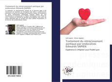 Bookcover of Traitement du rétrécissement aortique par endovalves Edwards SAPIEN