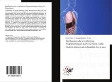 Buchcover von Perfusion de cisplatine hypotonique dans le foie isolé