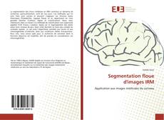 Capa do livro de Segmentation floue d'images IRM 