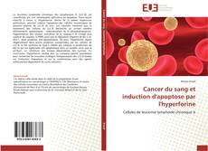 Copertina di Cancer du sang et induction d'apoptose par l'hyperforine