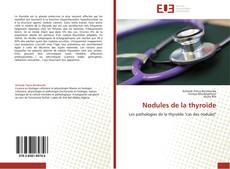 Buchcover von Nodules de la thyroïde