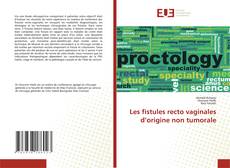 Buchcover von Les fistules recto vaginales d’origine non tumorale