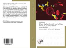 Effets du Remicade® sur le SI au cours de la polyarthrite rhumatoïde kitap kapağı