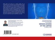 Bookcover of BENIGN LESIONS OF THE LARYNX