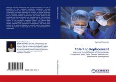 Bookcover of Total Hip Replacement