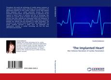 ''The Implanted Heart'' kitap kapağı