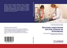 Buchcover von Лечение  переломов  костей  голени по Илизарову
