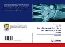 Couverture de Role of Osteoactivin in Bone Formation and Fracture Repair