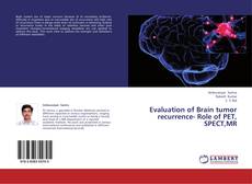 Bookcover of Evaluation of Brain tumor recurrence- Role of  PET, SPECT,MR