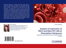 Copertina di Analysis of expression of PDCP and MAL13P1.308 of Plasmodium falciparum