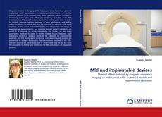 Portada del libro de MRI and implantable devices