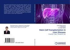 Stem Cell Transplantation In Liver Diseases kitap kapağı