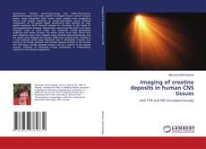 Borítókép a  Imaging of creatine deposits in human CNS tissues - hoz