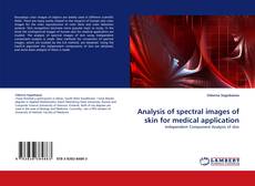 Bookcover of Analysis of spectral images of skin for medical application