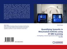 Quantifying Synovitis in Rheumatoid Arthritis using 3T MRI Scanning的封面