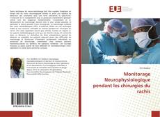 Bookcover of Monitorage Neurophysiologique pendant les chirurgies du rachis