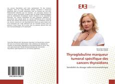 Thyroglobuline marqueur tumoral spécifique des cancers thyroïdiens的封面