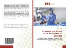 Portada del libro de Le cancer localement avancé de la tête du pancréas
