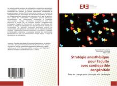Stratégie anesthésique pour l'adulte avec cardiopathie congénitale的封面