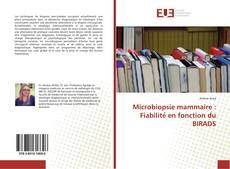 Microbiopsie mammaire : Fiabilité en fonction du BIRADS kitap kapağı