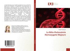 Buchcover von La Bêta-thalassémie Homozygote Majeure