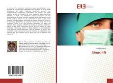 Bookcover of Sinus lift