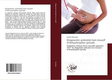 Diagnostic prénatal non invasif d’Amyotrophie spinale kitap kapağı