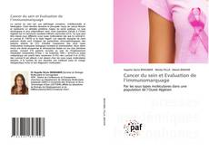 Buchcover von Cancer du sein et Evaluation de l’immunomarquage