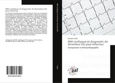 Buchcover von IRM cardiaque et diagnostic de thrombus VG post-infarctus