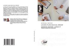 Bookcover of LICHEN PLAN BUCCAL EROSIF
