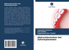 Bookcover of Abdrucktechniken bei Zahnimplantaten