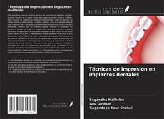 Copertina di Técnicas de impresión en implantes dentales