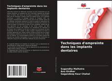Borítókép a  Techniques d'empreinte dans les implants dentaires - hoz